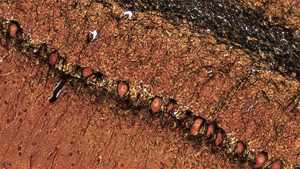 Microscopic view of a central nervous system